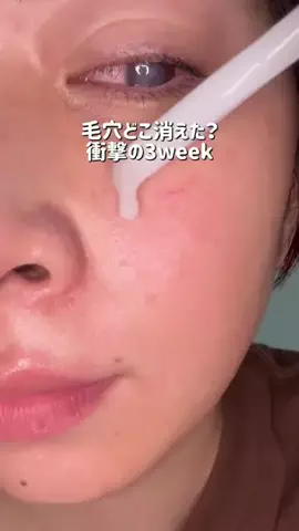 ビザちゃんのTikTok投稿