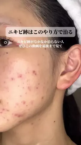 きららのTikTok投稿