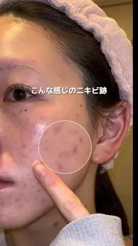 きららのTikTok投稿