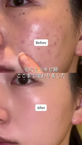 きららのTikTok投稿