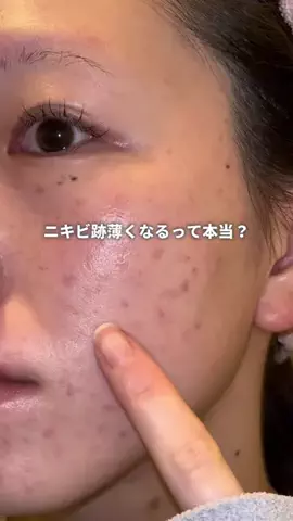 きららのTikTok投稿