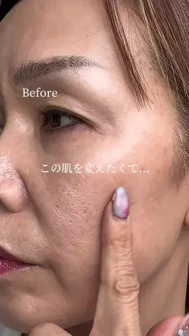 美容ﾈｷのTikTok投稿