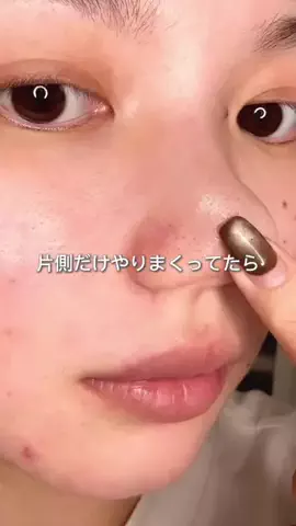 ゆい〻美容クリニック勤務のTikTok投稿