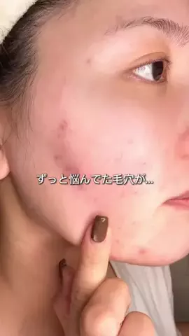 ゆい〻美容クリニック勤務のTikTok投稿