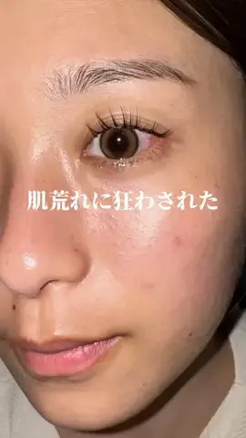 ナラ｜毛穴ケアオタク🍓のTikTok投稿