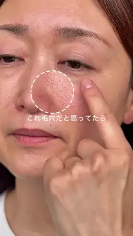 ハナマル｜垢抜け記録のTikTok投稿