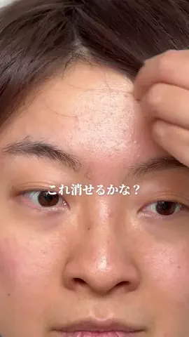 ハナマル｜垢抜け記録のTikTok投稿