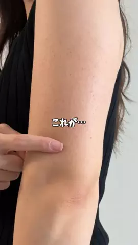 yua@垢抜けのTikTok PR投稿：「毛穴も黒ずみも気になる…」って人に🫧 ボディも顔と…