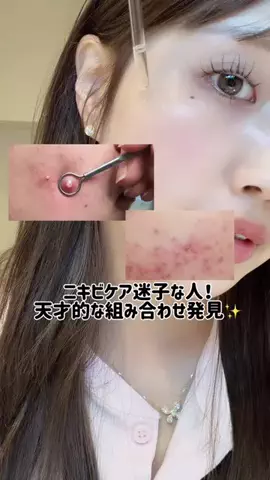 華世【滑り台ツヤ肌美容】のTikTok投稿
