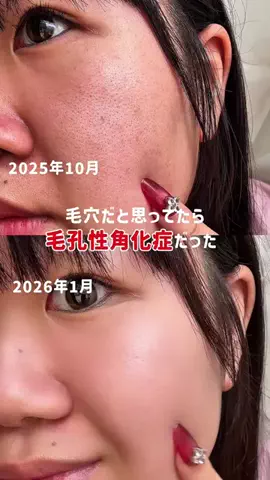 emuno_akanukeのTikTok投稿