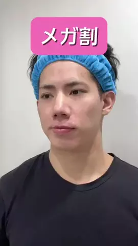 アクネ君🧑🏻‍🦱🧼🪒【美容系•垢抜け】のTikTok投稿