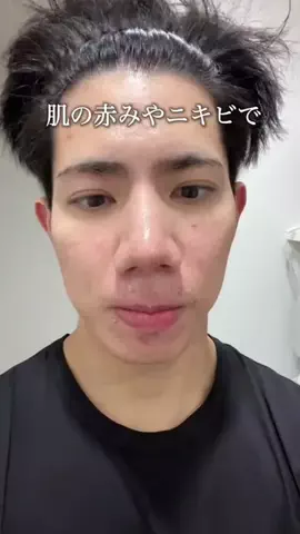 アクネ君🧑🏻‍🦱🧼🪒【美容系•垢抜け】のTikTok投稿