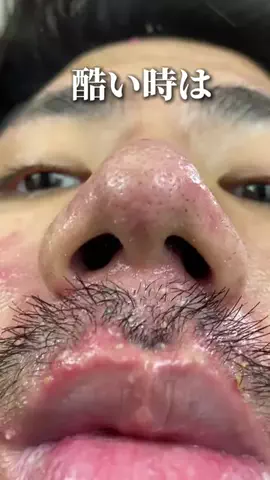 アクネ君🧑🏻‍🦱🧼🪒【美容系•垢抜け】のTikTok投稿