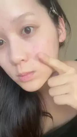 先天性眼瞼下垂(ゆな)のTikTok投稿