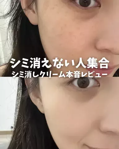 あみ|シミュートのTikTok投稿