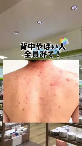 yuriのTikTok投稿