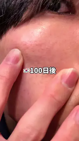 りん｜100日後韓国人になる会社員のTikTok投稿