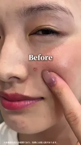 心配嬢👸🏻のTikTok投稿
