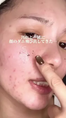 肌ちゅるんヘヨ👶🏻のTikTok投稿
