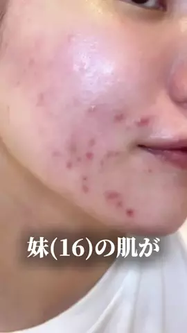 肌ちゅるんヘヨ👶🏻のTikTok投稿