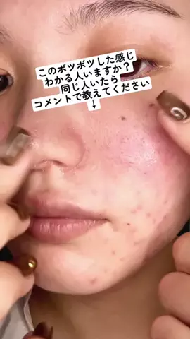 肌ちゅるんヘヨ👶🏻のTikTok投稿
