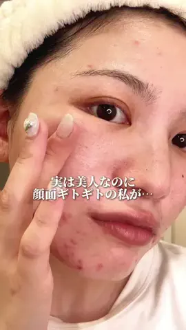 肌ちゅるんヘヨ👶🏻のTikTok投稿