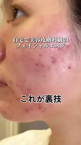 肌ちゅるんヘヨ👶🏻のTikTok投稿