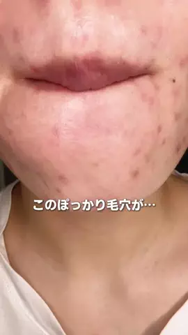 肌ちゅるんヘヨ👶🏻のTikTok投稿