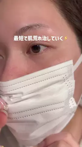 ちゃがわ@美肌検証垢💉💖のTikTok投稿