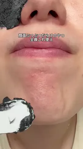 ちゃがわ@美肌検証垢💉💖のTikTok投稿