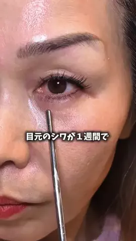 美容ﾈｷのTikTok投稿
