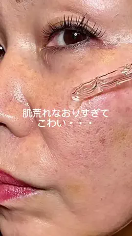 美容ﾈｷのTikTok投稿