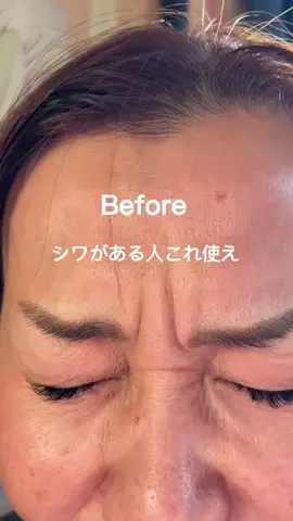 美容ﾈｷのTikTok投稿