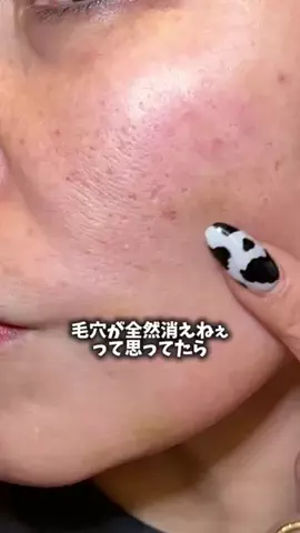 美容ﾈｷのTikTok投稿