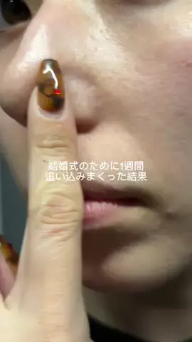美容ﾈｷのTikTok投稿