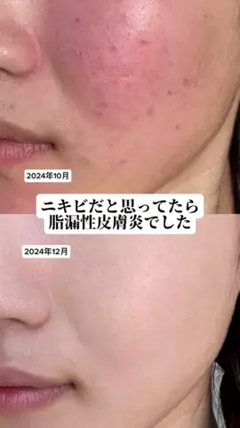 はる🐣🍓【美容垢】のTikTok投稿