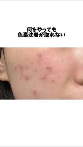 はる🐣🍓【美容垢】のTikTok投稿