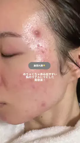りょくにかちゃのTikTok投稿