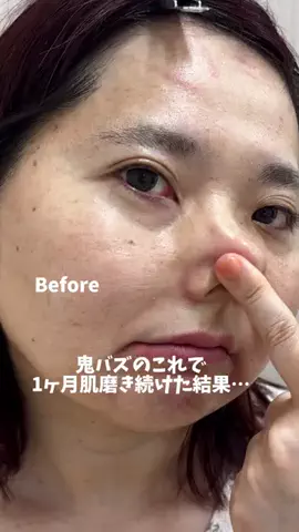 マダム美容✨のTikTok投稿