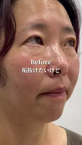 マダム美容✨のTikTok投稿
