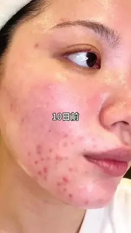 あかね💍のTikTok投稿