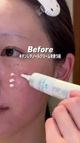 きららのTikTok投稿