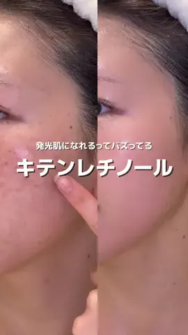 きららのTikTok投稿