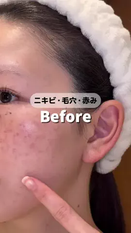きららのTikTok投稿
