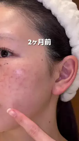 きららのTikTok投稿
