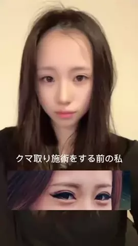 こばれみ🖤🫧のTikTok投稿