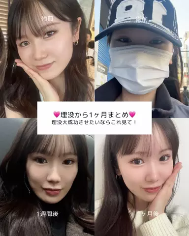垢抜け日記ちゃんのTikTok投稿