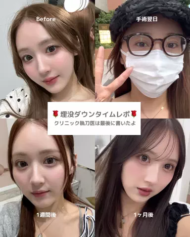 垢抜け日記ちゃんのTikTok投稿