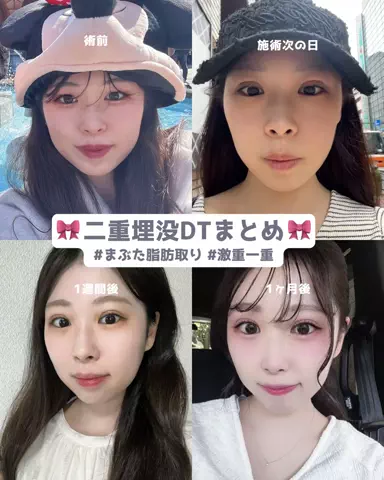 垢抜け日記ちゃんのTikTok投稿