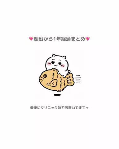 垢抜け日記ちゃんのTikTok投稿